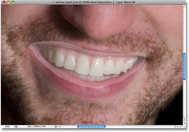 After brightening his teeth, the rest of the selected area has also been brightened. Image © 2008 Photoshop Essentials.com.